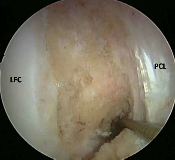 Fig. 3