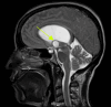 Figure 2 A: