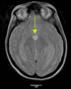 Figure 2 B: