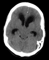 Figure 1 B: