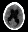 Figure 1 A: