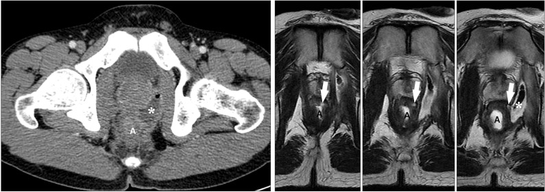 Fig. 13