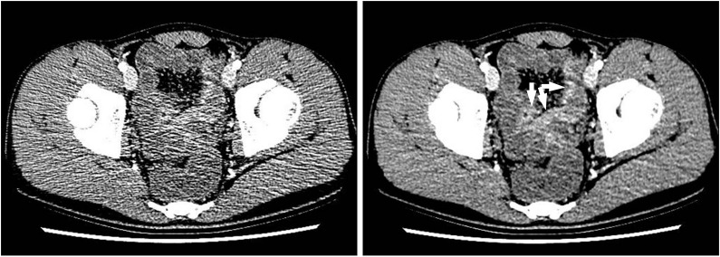 Fig. 5