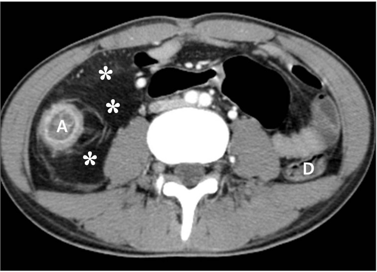 Fig. 12