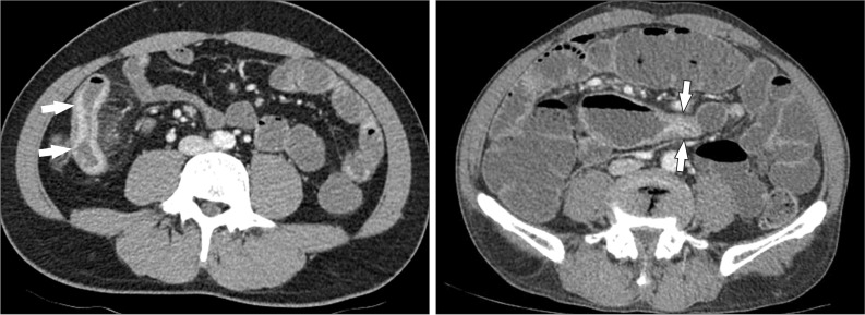 Fig. 10