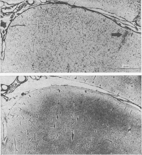 Fig. 11