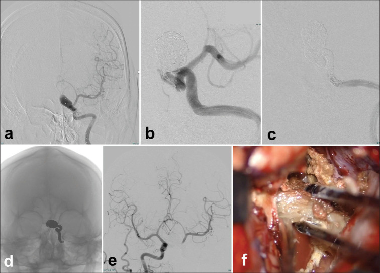 Figure 4: