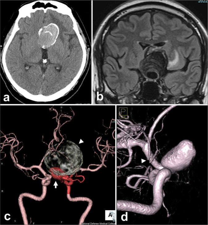 Figure 3: