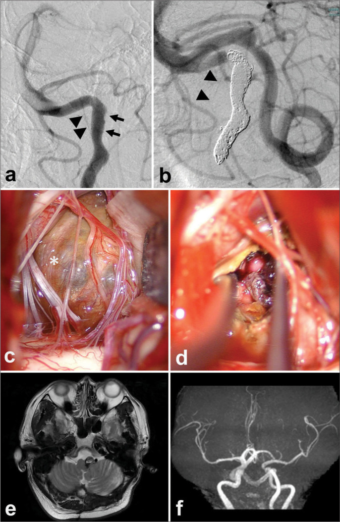 Figure 2: