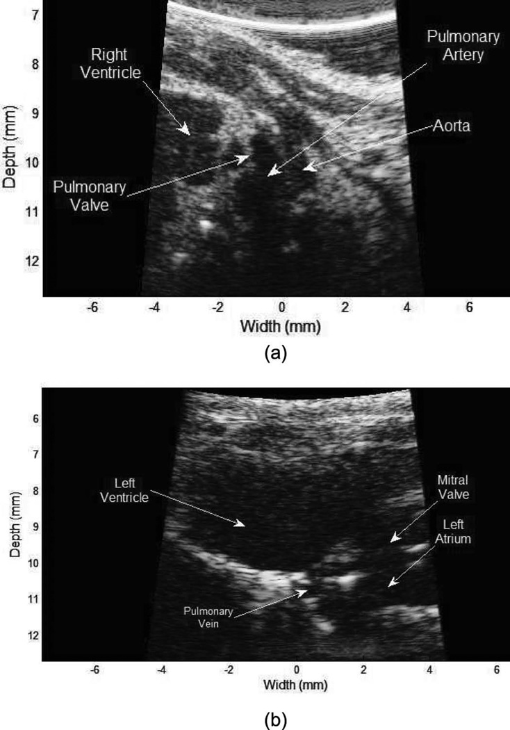 Fig. 11