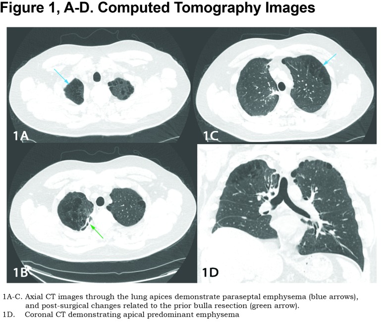 graphic file with name JCOPDF-5-81-f001.jpg