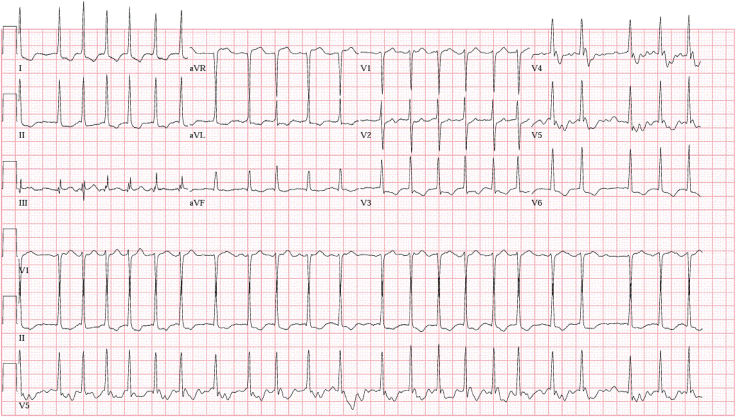 Figure 1