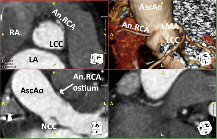 Figure 4