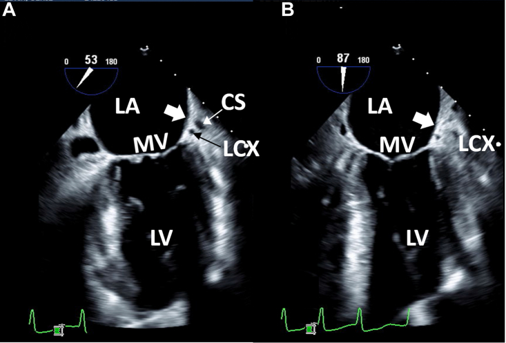 Figure 2