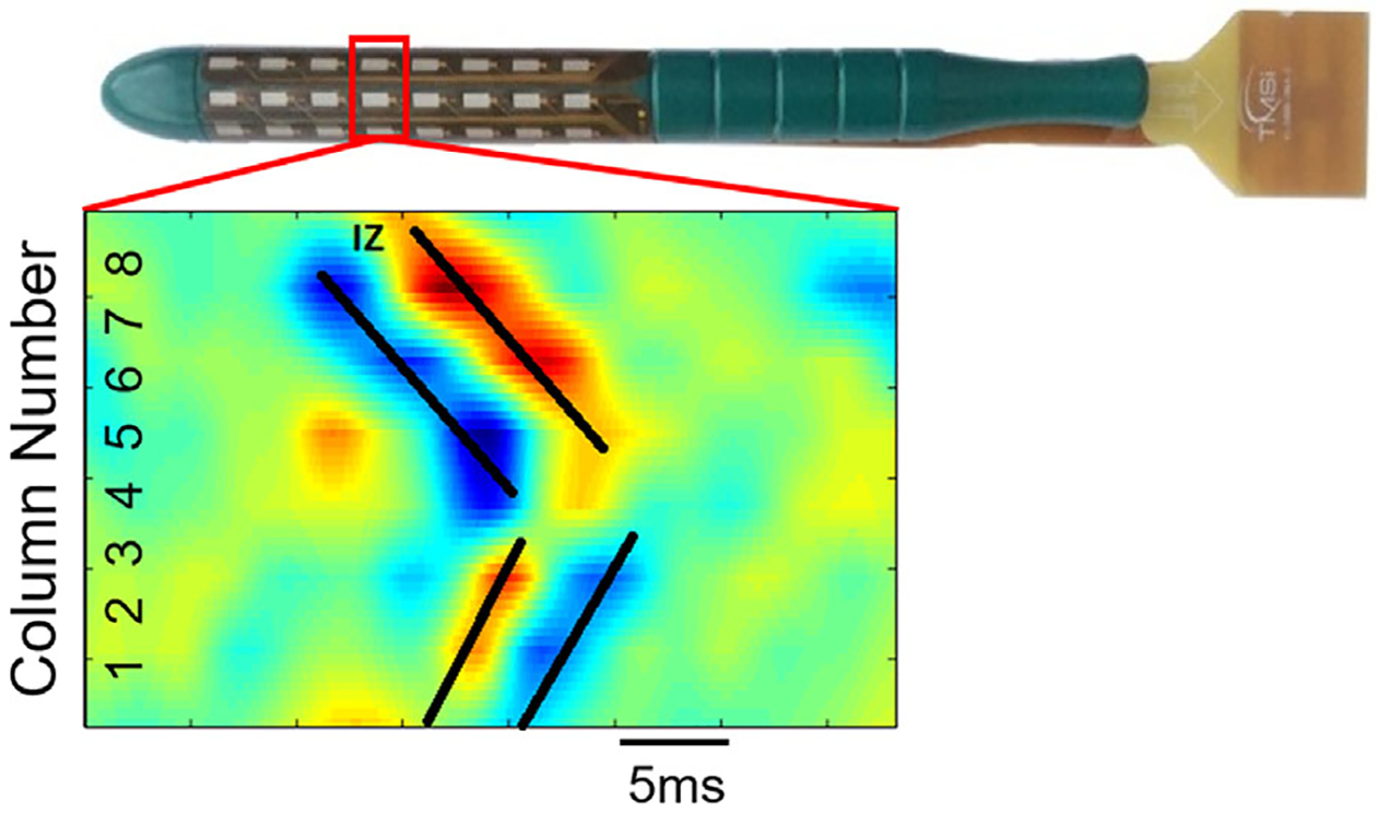 FIGURE 3