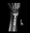 Fig. 4