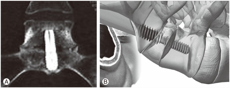 Fig. 11