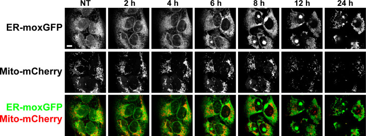 Figure 3—figure supplement 5.