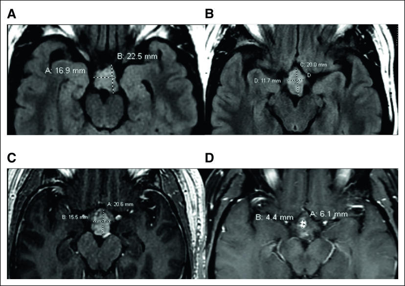 FIG 1.