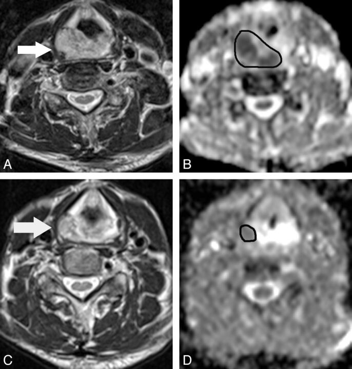 Fig 3.