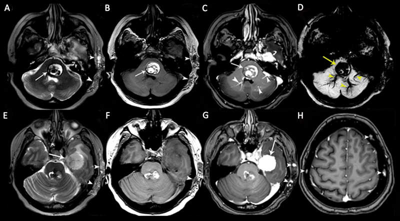 Fig. 11