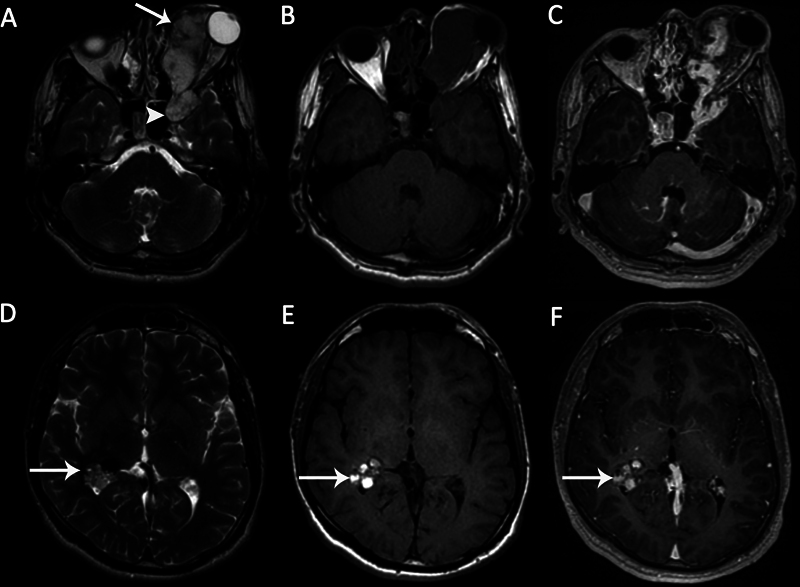 Fig. 10