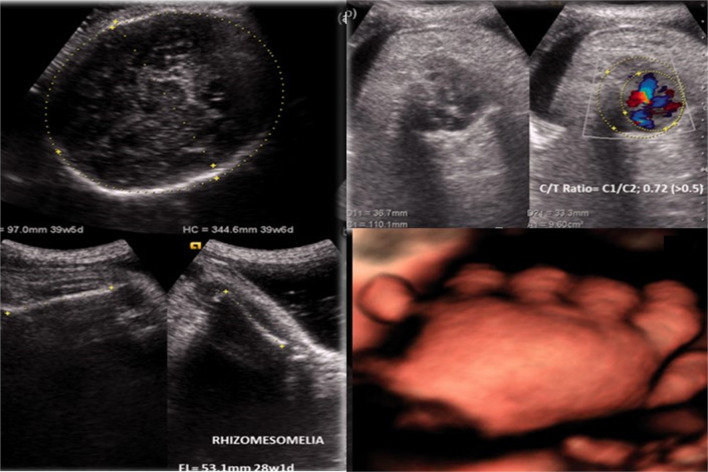 Fig. 5