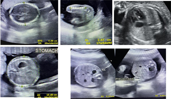 Fig. 1
