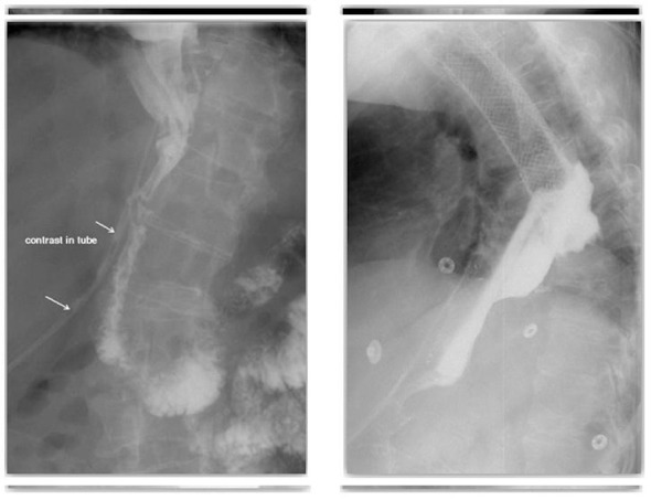 Figure 3 and Figure 4