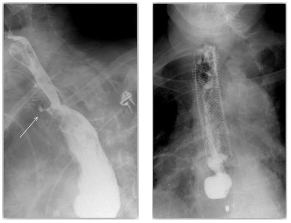 Figure 1 and Figure 2