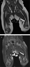 Figure 2. a, b