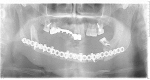 Fig. 8