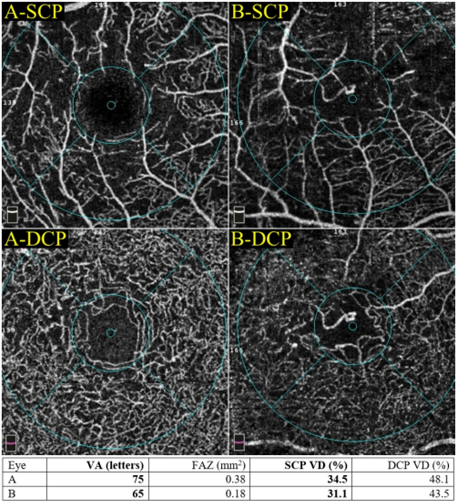 Fig. 11.