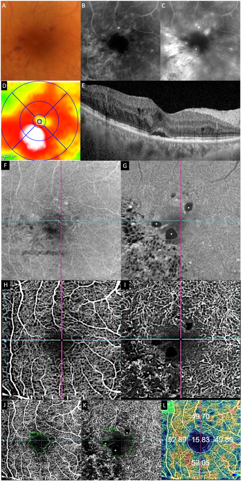 Fig. 3.