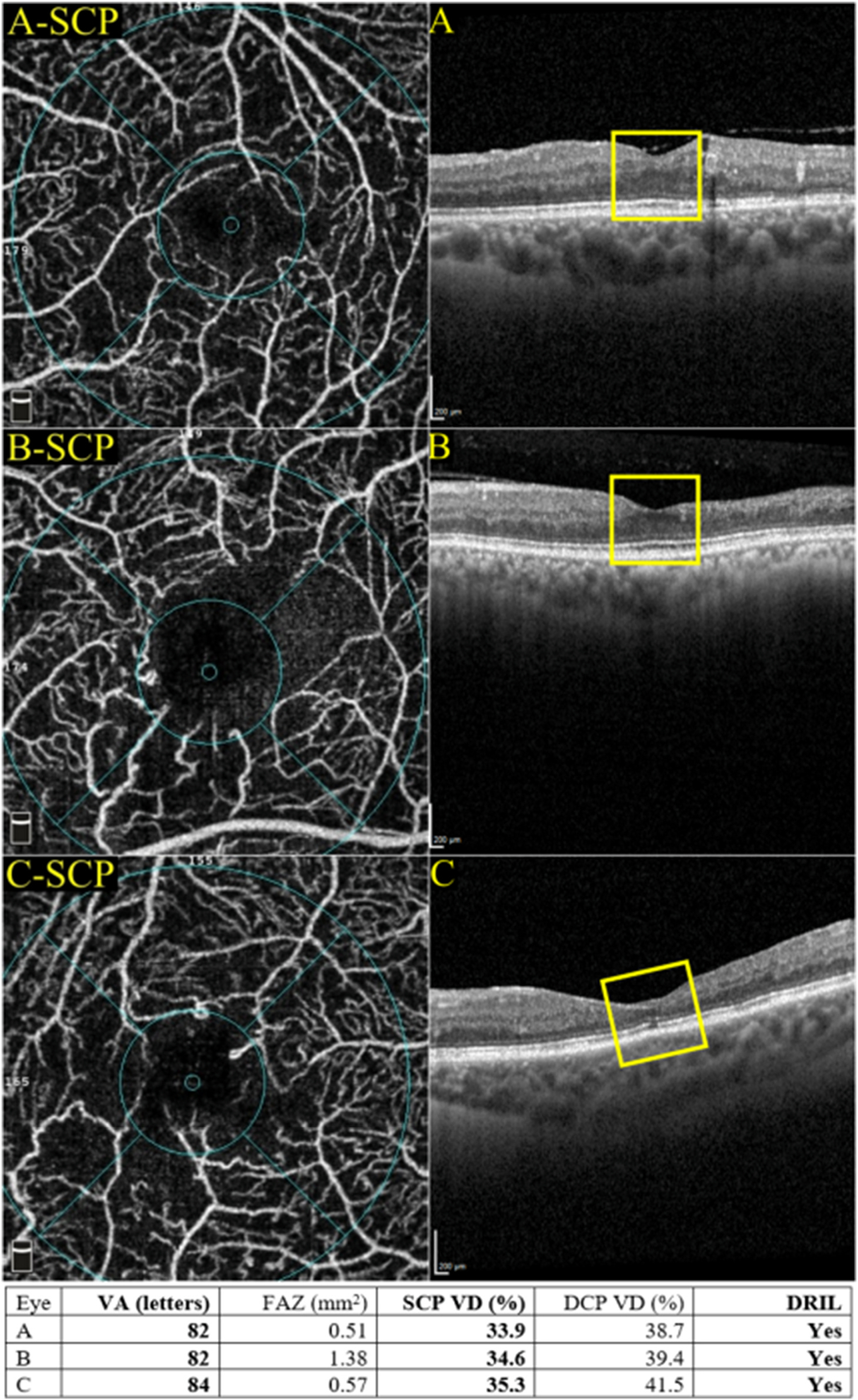 Fig. 13.