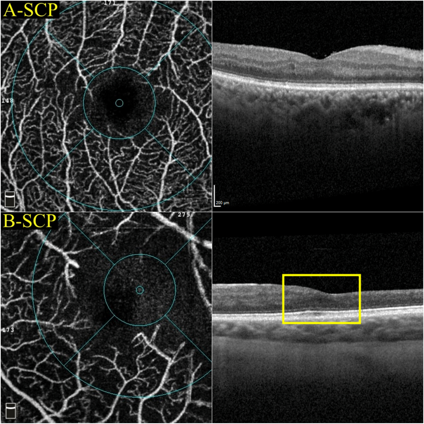 Fig. 12.