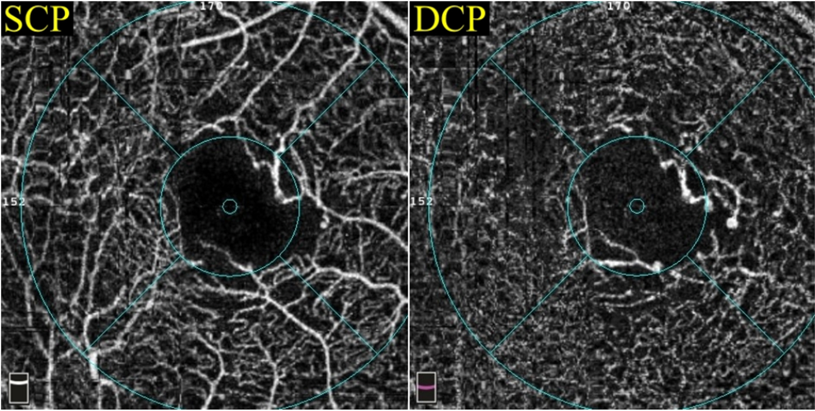 Fig. 10.