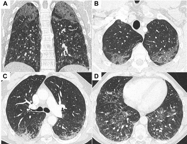 Figure 2