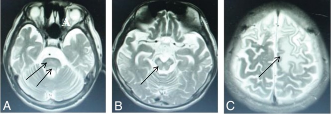 Fig 3.