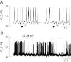 FIG. 3