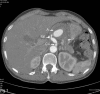Fig.1