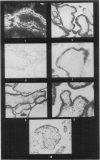176-1