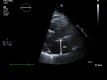 Figure 3b.