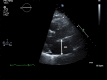 Figure 4a.