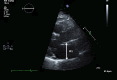 Figure 3a.