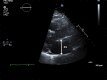 Figure 2a.