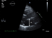 Figure 1b.