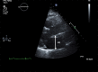 Figure 2b.