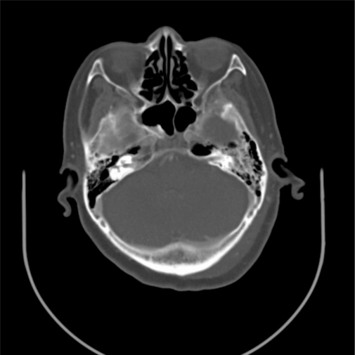 Figure 2: