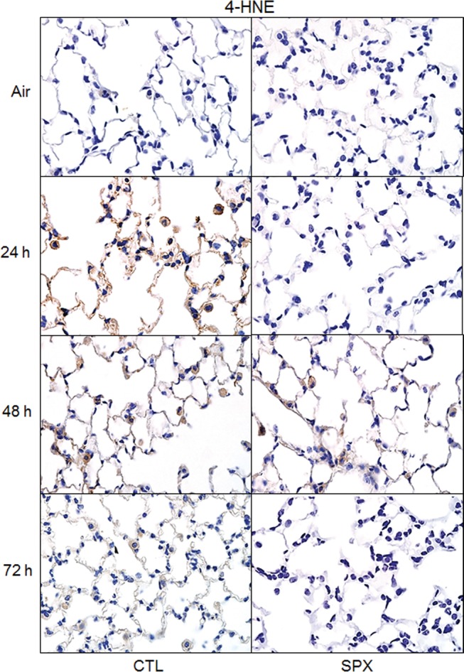 FIG. 11